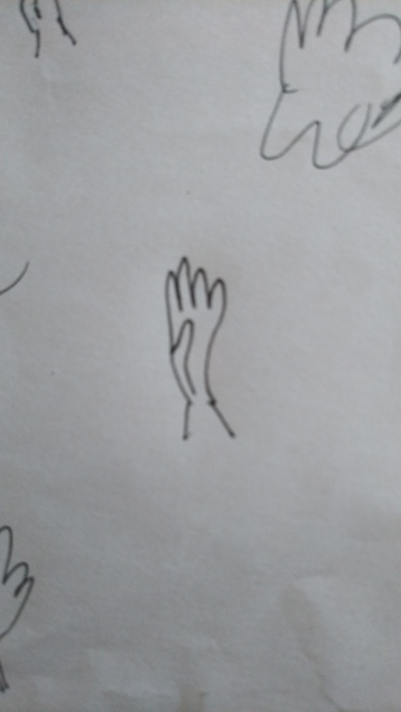 手