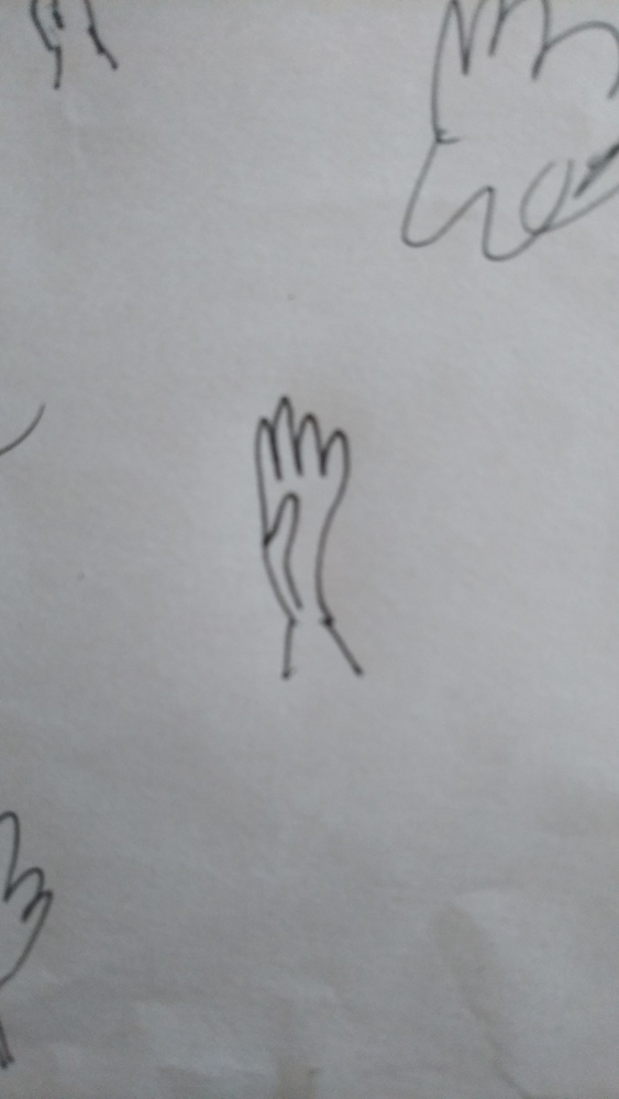 手